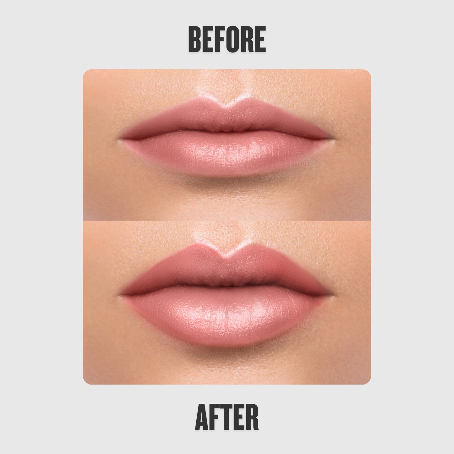 Reedle Shot Lip Plumper™