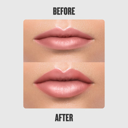 Reedle Shot Lip Plumper™