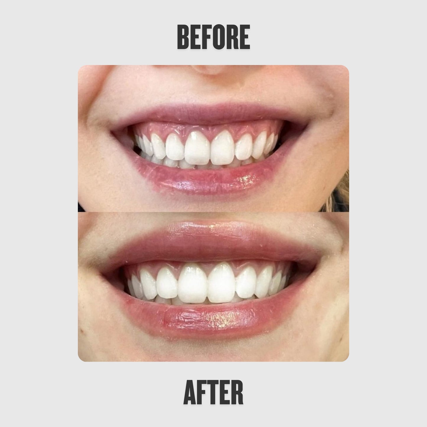 Reedle Shot Lip Plumper™
