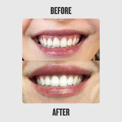 Reedle Shot Lip Plumper™